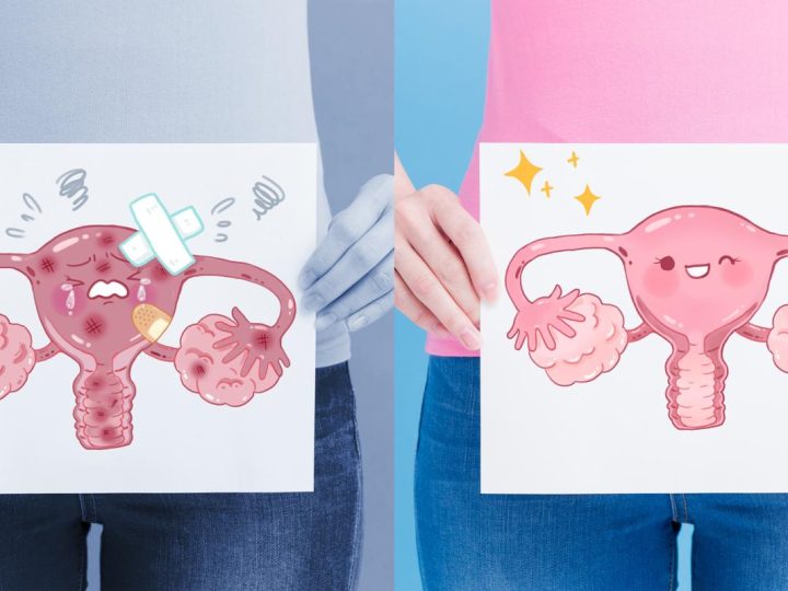 El giro que esperábamos: identificar el cáncer de ovario con un test de orina ahora será posible