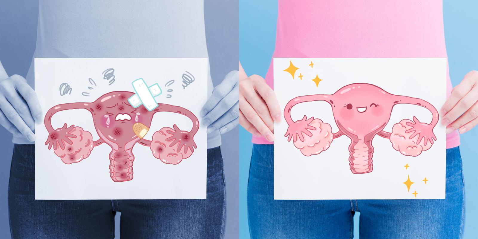 El giro que esperábamos: identificar el cáncer de ovario con un test de orina ahora será posible
